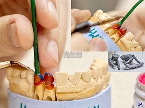 Как делают зубы